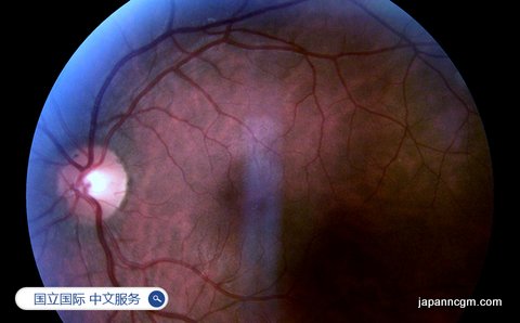 日本国立国际 医疗研究中心 中文服务