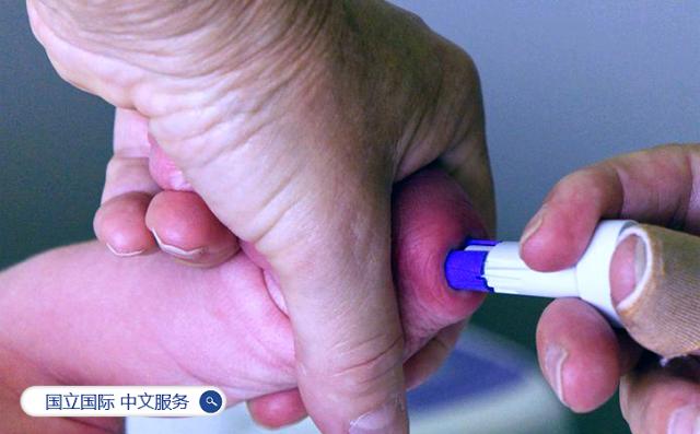 日本国立国际 医疗研究中心 中文服务